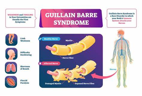 Understanding the Puzzling Guillain-Barré Syndrome